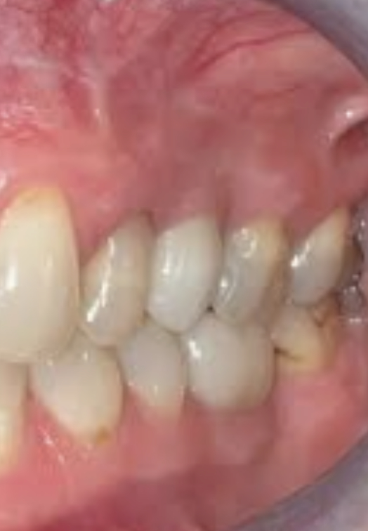 stav-18-mesicu-emdental